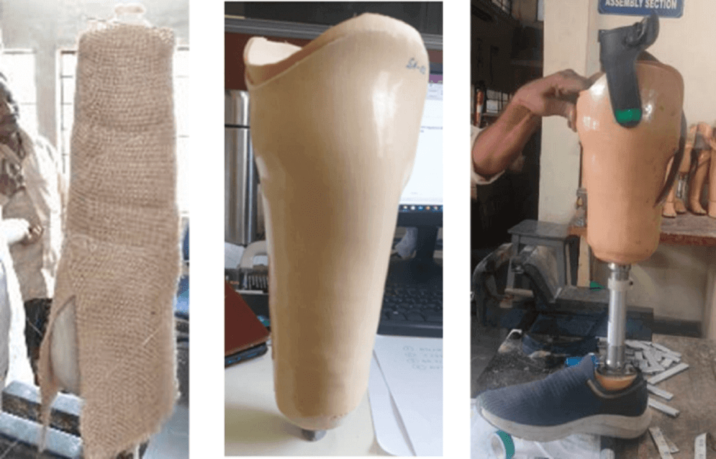 Jute Fiber Composites: A Sustainable Socket Material for Prosthetic Legs